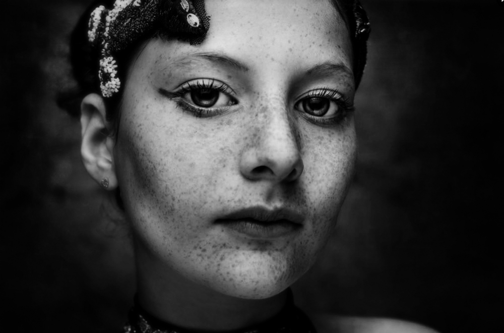 freckles freckles